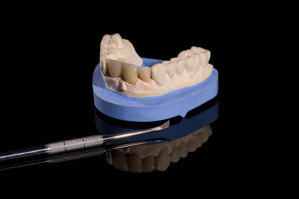 Primo Piano Della Dentizione Artificiale Impronta Dentale Con Uno Strumento — Foto Stock