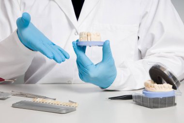 Diş hekimi / diş teknisyeninin eldiveni kullanıma hazır yapay dişli bir diş izi sunuyor.