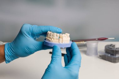 Diş hekimi / diş teknisyeninin eldiveni kullanıma hazır yapay dişli bir diş izi sunuyor.