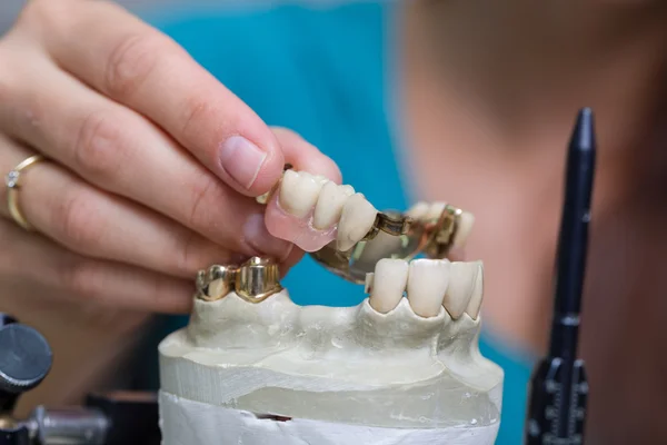 En un laboratorio dental — Foto de Stock