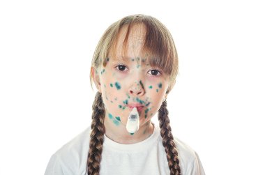 Kız hasta suçiçeği termometre sıcaklık ölçer