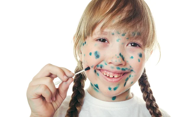 Kız hasta suçiçeği gülümseyen