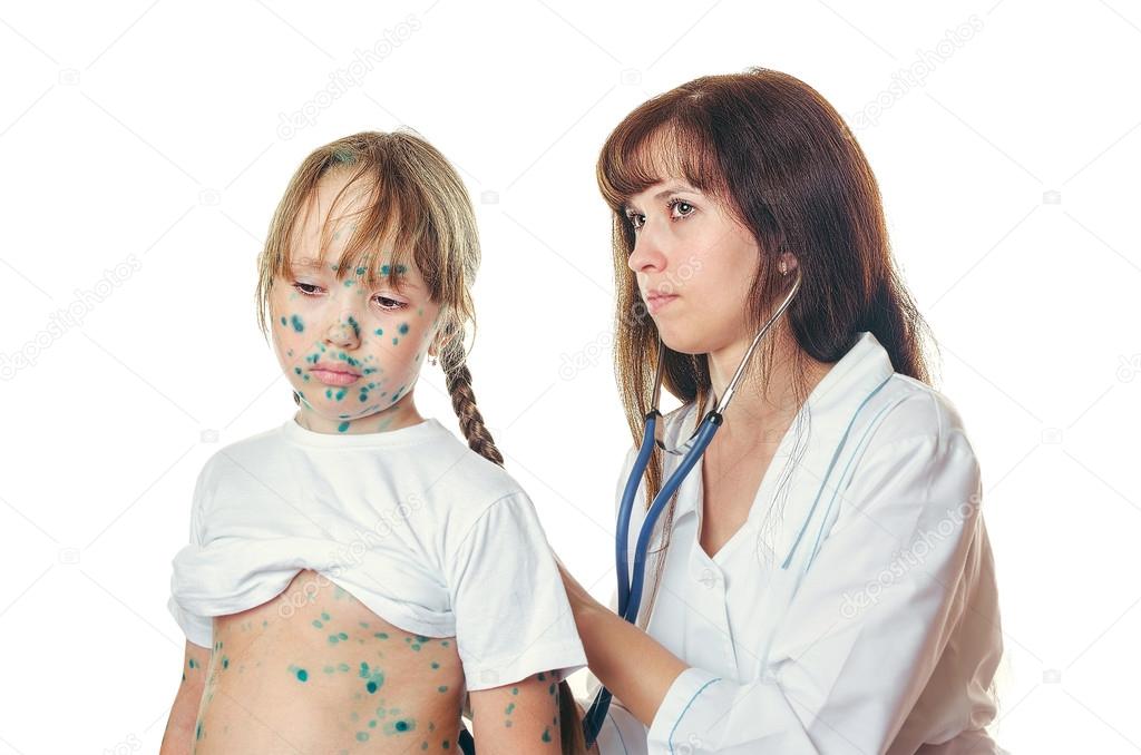 Ветрянка у детей информация сыпь по дням. Ветрянка вызывать врача или идти в поликлинику. Периоды заболевания ветряной оспы. Ветряная оспа высыпания сыпь. Ветрянка вызывать врача или идти в поликлинику.