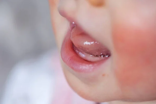 Retrato Cerca Una Boca Bebé Con Los Dos Primeros Dientes — Foto de Stock