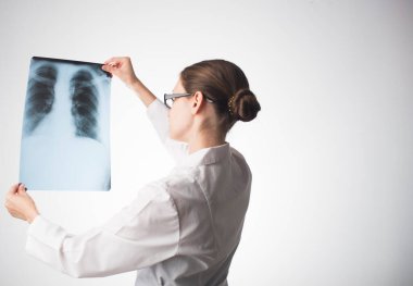 Doktor göğüs röntgeni çekiyor.