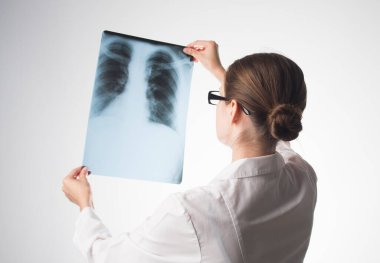 Doktor göğüs röntgeni çekiyor.