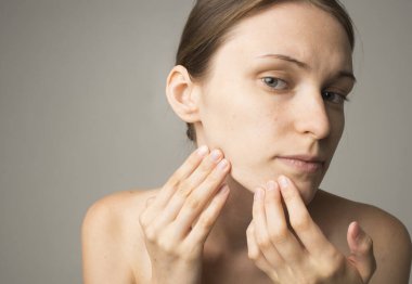 Sivilceli bir kadın.