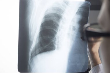 Travmatoloji cerrahı Roentgenogram X-ray
