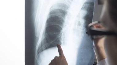 Travmatoloji cerrahı Roentgenogram X-ray