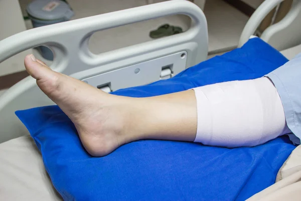 Verbonden been op een ziekenhuisbed. — Stockfoto