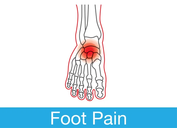 İç ayak ağrı — Stok Vektör