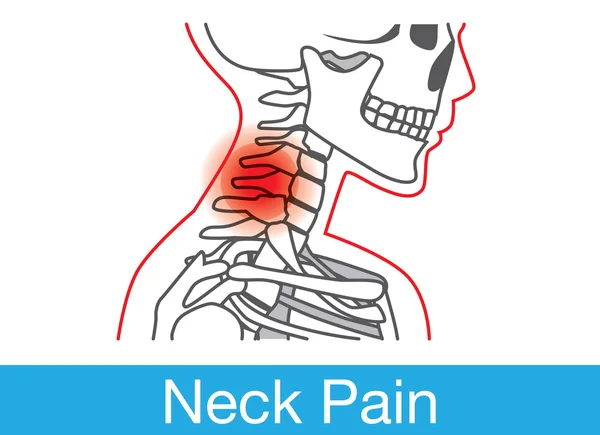 Neck pain outline — Stock Vector