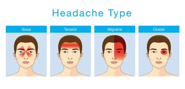 Tipo de dolor de cabeza — Vector de stock