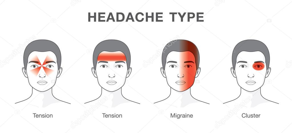 Type of headache