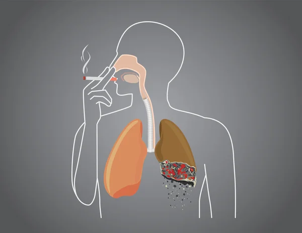 Mensch verbrannte Lunge beim Rauchen — Stockvektor