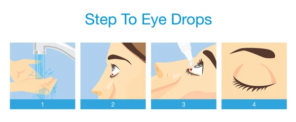 Tratamiento paso a ojo con gotas para los ojos — Archivo Imágenes Vectoriales