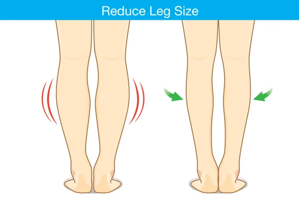 Ridurre le dimensioni delle gambe — Vettoriale Stock