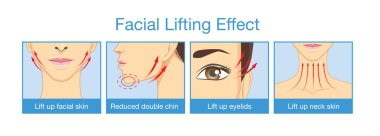 Kadınların yüz kaldırma etkisi