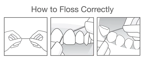 Comment utiliser correctement la soie dentaire pour nettoyer les dents — Image vectorielle