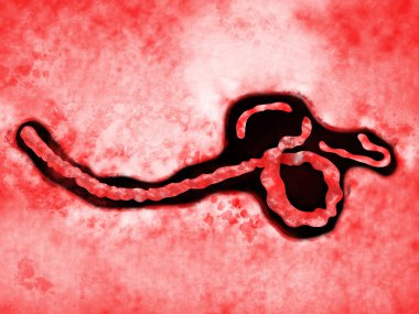 Ebola