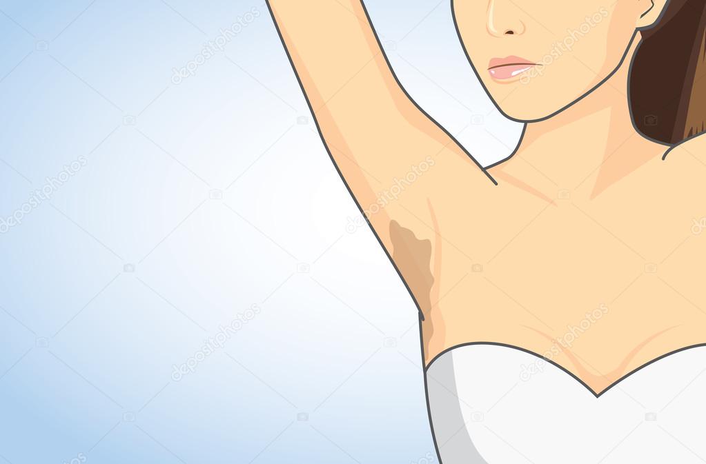 Armpit skin discoloration