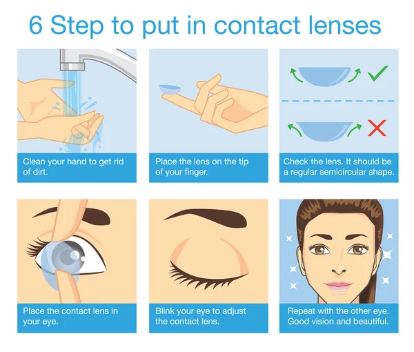 Stap te zetten in contact lens — Stockvector