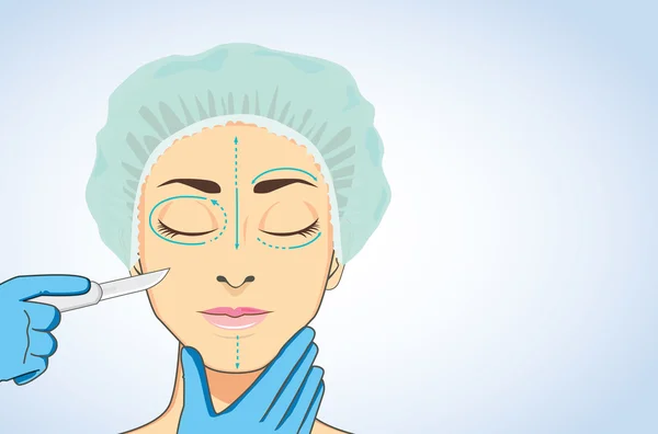 Mujer lista para cirugía estética — Vector de stock