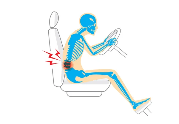 Back pain because wrong posture in driving — Stock Vector