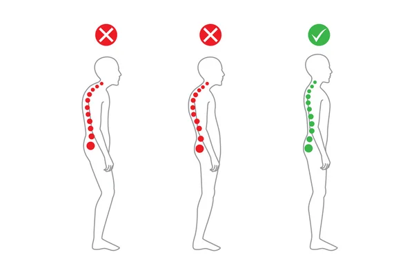 Alineación correcta del cuerpo en postura de pie — Vector de stock