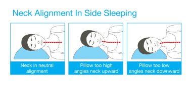 Neck alignment in side sleeping vector Neck alignment in side sleeping vector