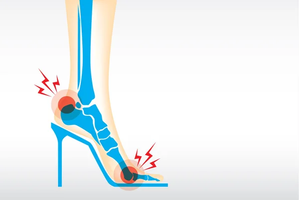 Foot pain by wearing high heels. — Stock Vector