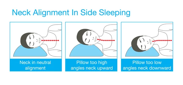 Alignement du cou dans le sommeil latéral — Image vectorielle