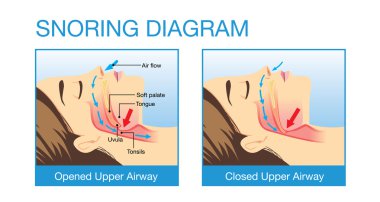 Horlama süre insan hava yolu anatomisi