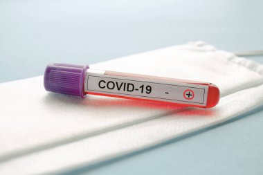 Pozitif test sonuçları COVID-19, yeni Coronavirus 2019 Wuhan, Çin 'de bulundu. COVID-19 'daki kan örneğinin laboratuvar incelemesi. 2019-NCoV testi.