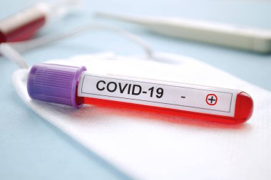 Pozitif test sonuçları COVID-19, yeni Coronavirus 2019 Wuhan, Çin 'de bulundu. COVID-19 için pozitif kan testi yapılan test tüpü. COVID-19 'daki kan örneğinin laboratuvar incelemesi. 2019-NCoV testi.