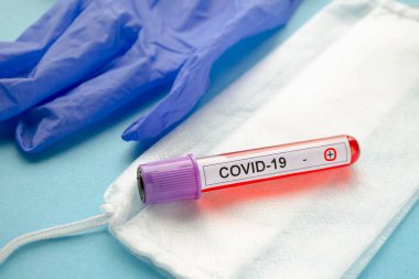 Pozitif test sonuçları COVID-19, yeni Coronavirus 2019 Wuhan, Çin 'de bulundu. COVID 19 için pozitif kan testi yapılan test tüpü..
