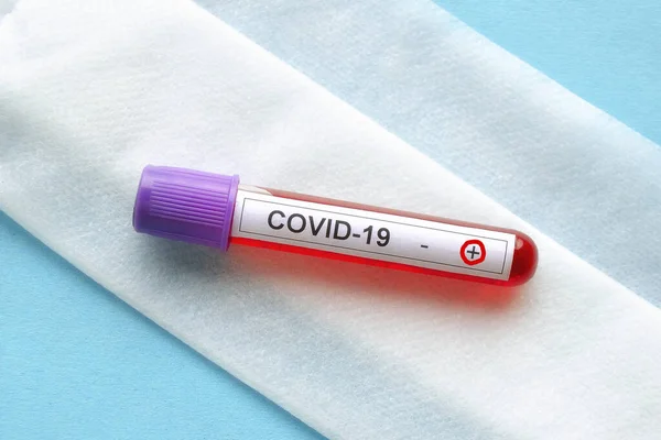 Pozitif test sonucu COVID-19, üst görünüm. 2019-NCoV testi. Düz yatıyordu.