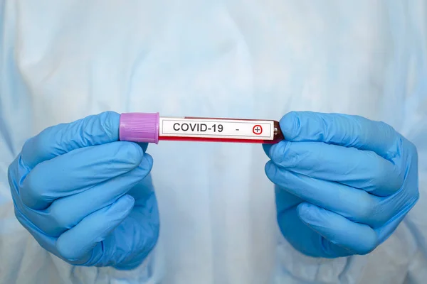 Positive test result COVID-19, novel coronavirus 2019 found in Wuhan, China. Test tube with a positive blood test for COVID-19.