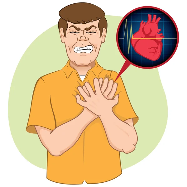 Ilustracja jest osoba pierwszej pomocy cierpiący na atak serca, CPR. idealny do samouczków pomocowych i podręczników medycznych — Wektor stockowy