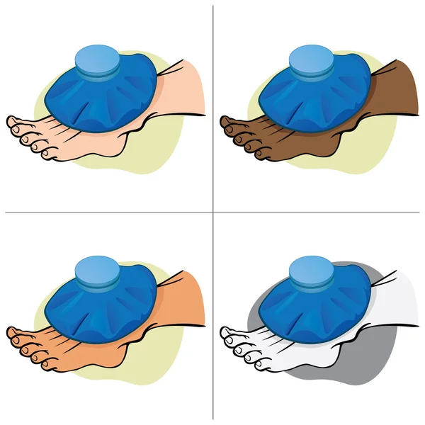 Ilustração Pessoa étnica de primeiros socorros, o pé com saco térmico. Ideal para catálogos, informações e guias médicos — Vetor de Stock