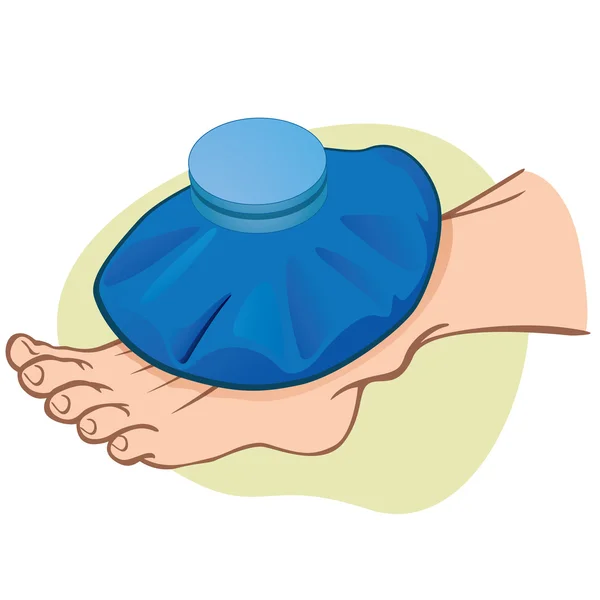 Ilustración Primeros auxilios Caucásico persona el pie con bolsa térmica. Ideal para catálogos, información y guías médicas — Archivo Imágenes Vectoriales
