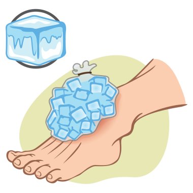 Illustration First Aid Caucasian person standing with ice pack. Ideal for catalogs, information and medical guides clipart