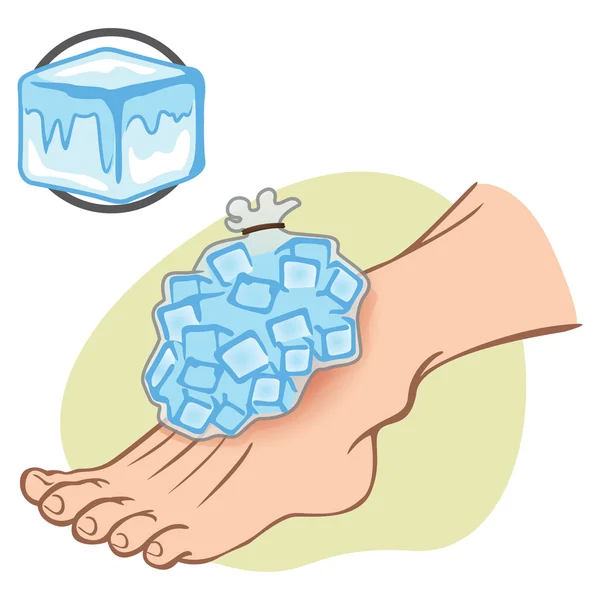 Ilustração Primeiros Socorros Caucasiano pessoa de pé com gelo pack. Ideal para catálogos, informações e guias médicos — Vetor de Stock