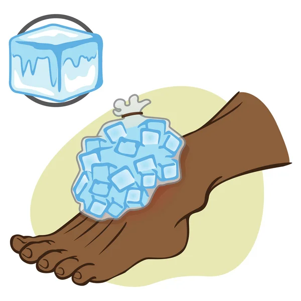 Ilustración Persona afrodescendiente de primeros auxilios de pie con bolsa de hielo. Ideal para catálogos, información y guías médicas — Vector de stock