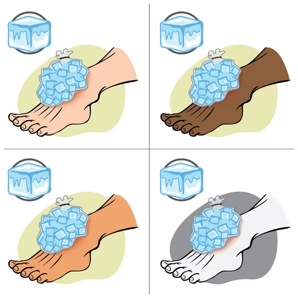 Ilustração Pessoa de primeiros socorros étnica, de pé com gelo pack. Ideal para catálogos, informações e guias médicos —  Vetores de Stock