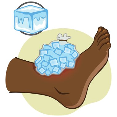 Illustration First Aid person african-descendant, standing side view, with ice pack. Ideal for catalogs, information and medical guides clipart