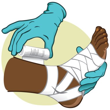 Illustration First Aid person african-descendant, standing side view, bandaging the feet, hands with gloves. Ideal for catalogs, information and medical guides clipart