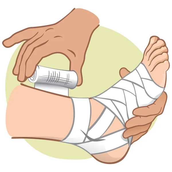 Ayak bandaj illüstrasyon ilk yardım kişi beyaz, ayakta yan görünüm. Kataloglar, bilgi ve tıbbi kılavuzları için idealdir — Stok Vektör
