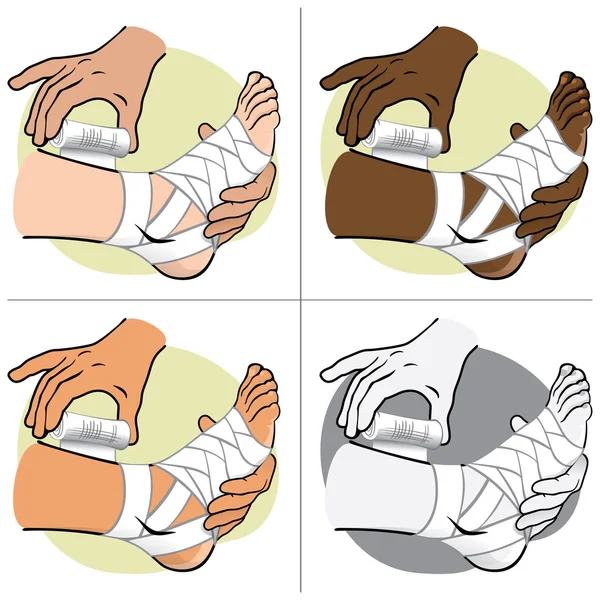 Ilustración Persona de primeros auxilios étnica, vista lateral de pie, vendaje del pie. Ideal para catálogos, información y guías médicas — Vector de stock