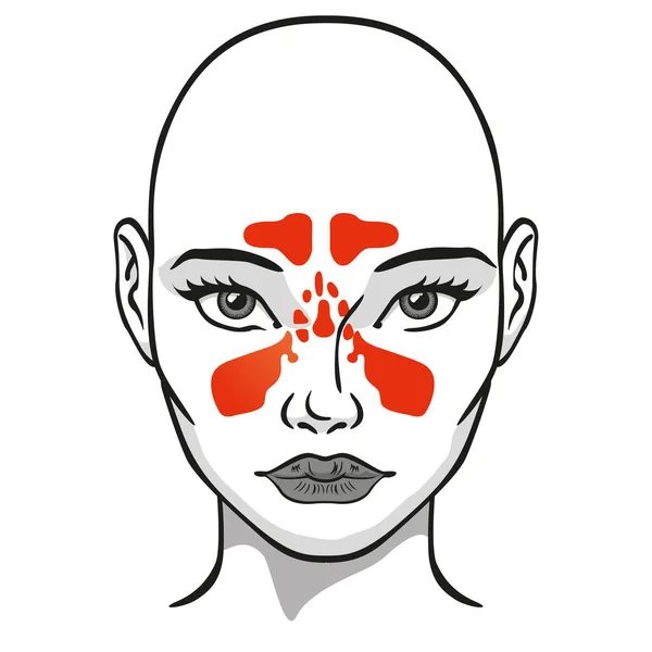 Illustration Nasenhöhlengesicht Nebenhöhlen Frau Ideal Für Kataloge Newsletter Und Medizin — Stockvektor